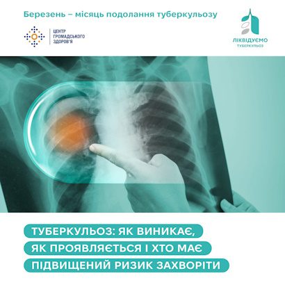 Туберкульоз: як виникає, як проявляється і хто має підвищений ризик захворіти